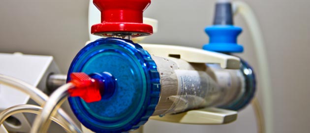 Dialysefilter
